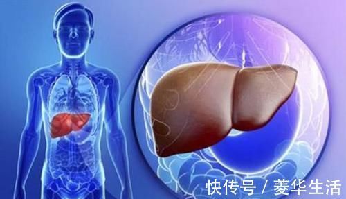 脂肪肝患者|脂肪肝患者,不妨多吃这几种食物,给肝脏“减肥”更健康