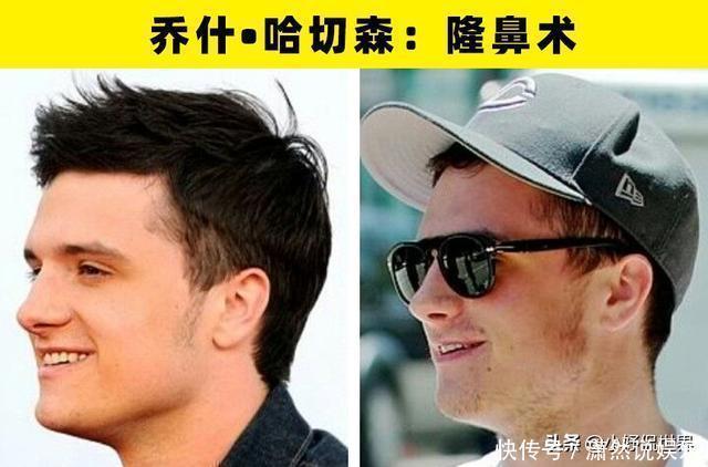 整容手术|大方承认自己做过整形手术的8名好莱坞明星