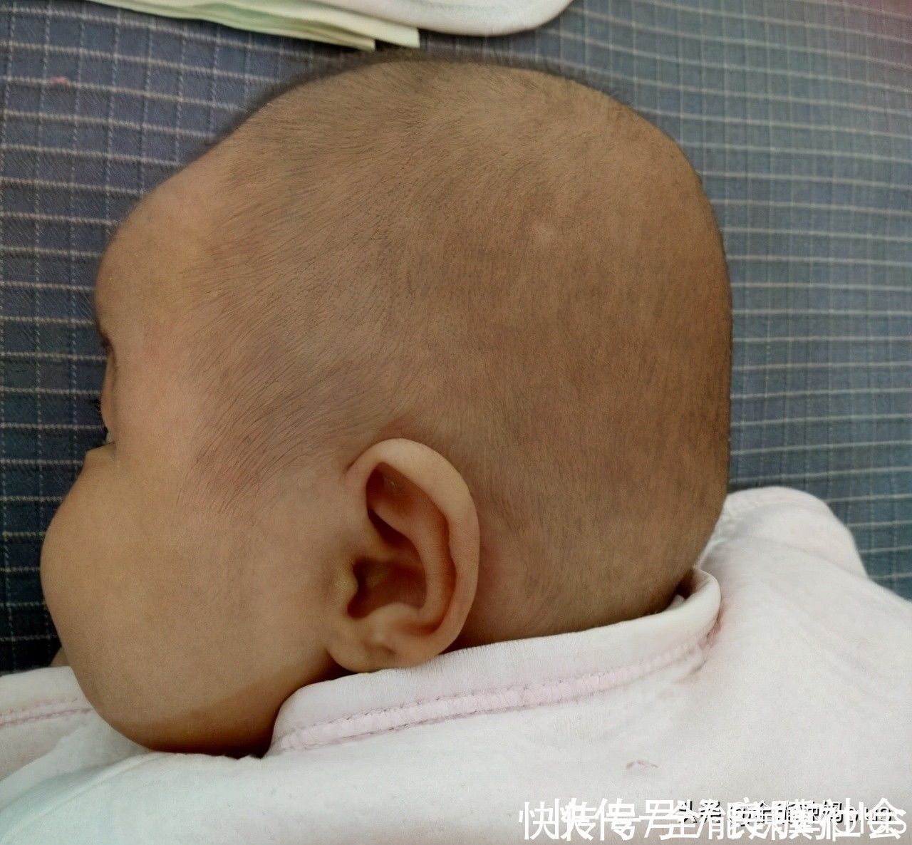 圆头|“妈求求你,别给我睡扁头了”扁头有多毁娃?3张对比图告诉你