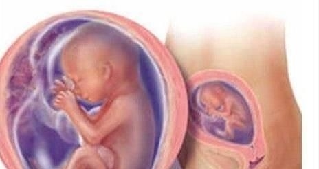 胎心|胎儿在妈妈肚子里也会缺氧,会这样小心的“提醒”妈妈