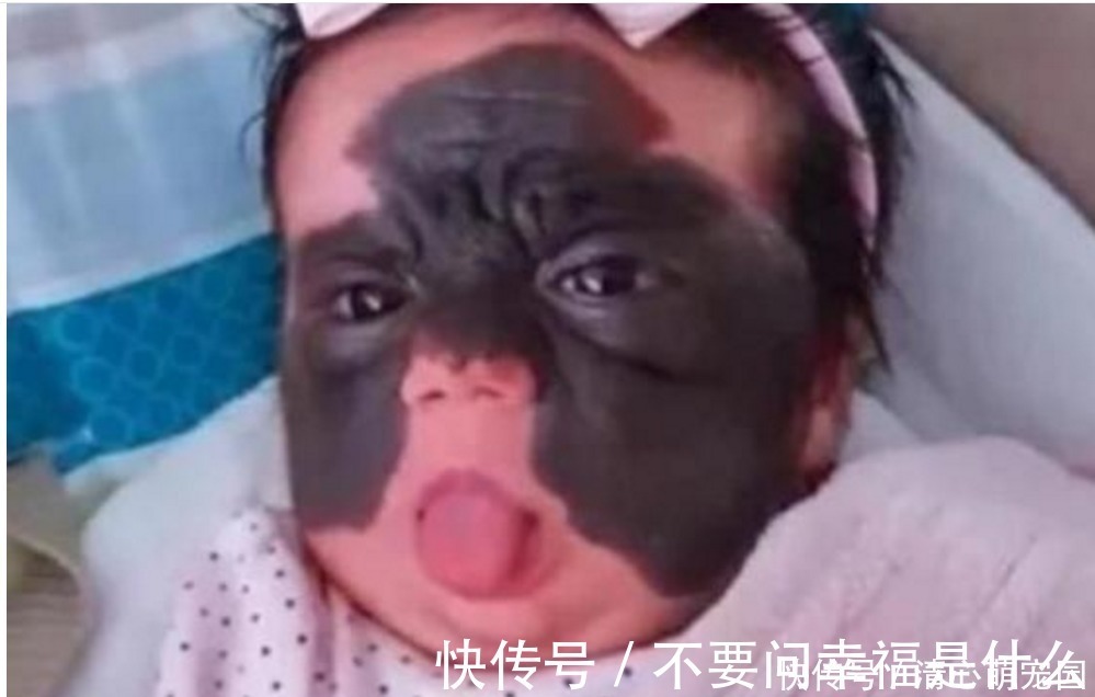 整容|女婴一出生伴随“蝙蝠侠印记”,被父母送去整容7次,结果怎样了