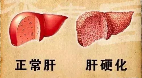 胃肠|一招抬脚功，能降百种病！每晚睡前5分钟，防病治病，延年益寿！