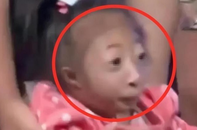 缺陷|湖南女子生下只“小猴子”,马戏团重金求购,宝妈的回答让人感动