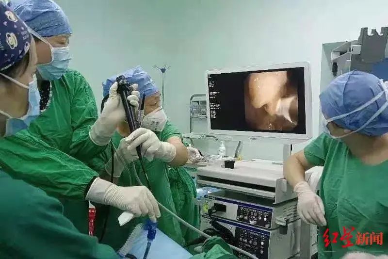 支气管镜|太惊险!成都阿姨险些丧命,只因一块小酥肉...