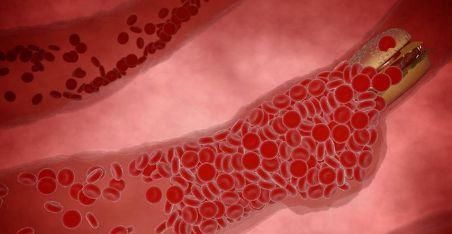 血管堵不堵,看脚就知,若你脚上没有3个现象,恭喜,血管还年轻