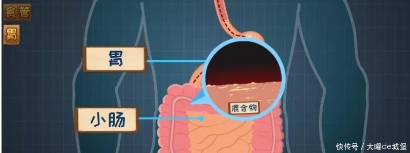 胃食管反流咋回事？反酸烧心背后真相是啥？胃食管反流发病机制