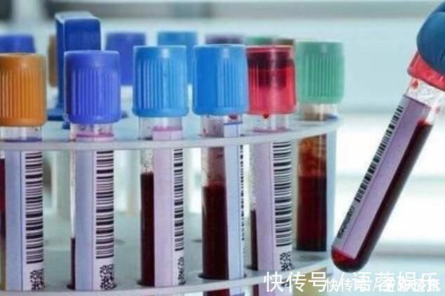 血糖|胰岛素“催化剂”找到了，比吃苦瓜管用，糖友敞开吃，血糖更稳定