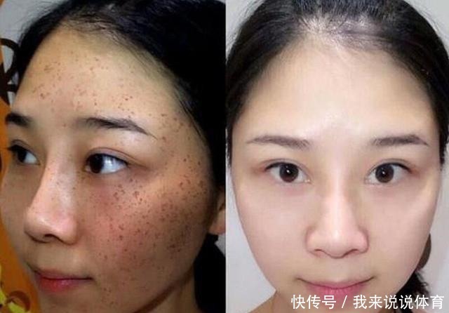 灯泡|建议“黑黄皮女生”选精华,别错过这3款,1个冬天白1个度