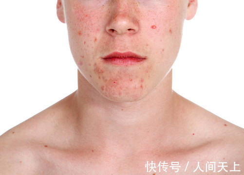 阿司匹林|十个坑人的“养生常识”,越养越病!别再盲目相信了