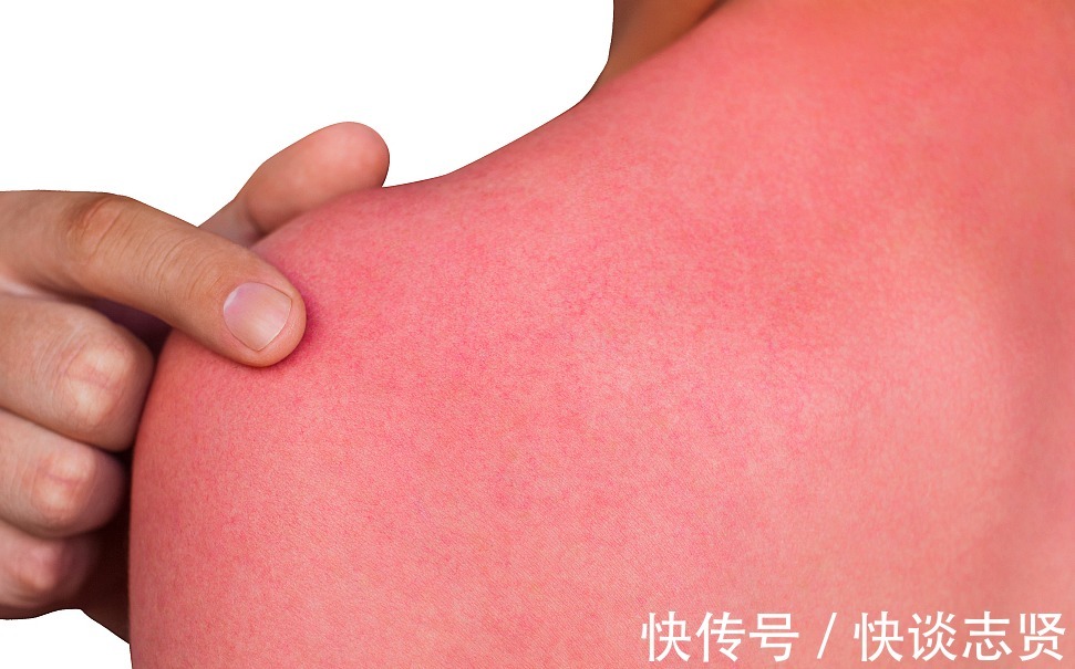 一次性|皮肤晒黑了怎么快速白回来?一次性告诉你,快速白回来的全部方法