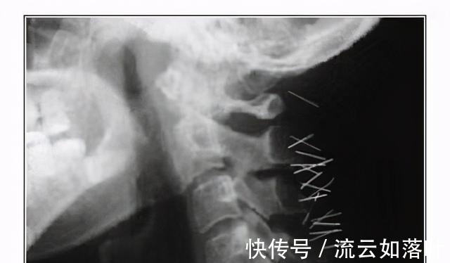 季光|《名侦探柯南》毛利大叔钱到底从哪里来的,这背后有啥秘密,富N代