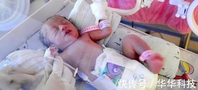 孕妇|70厘米高的孕妇冒生命危险产下女婴，婴儿出生后丈夫却泣不成声