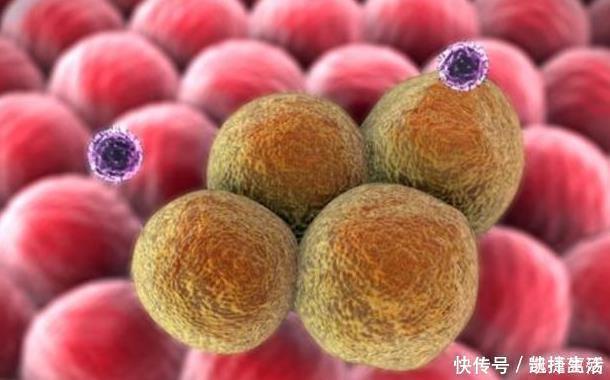 癌细胞|为什么癌症早期都不痛不痒、毫无症状看完受益终身