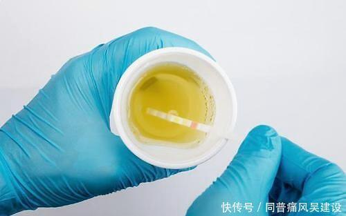 尿酸不高就没多大问题?