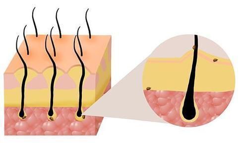 不论男女,经常用艾叶水洗头,解决不少烦恼,成本还低