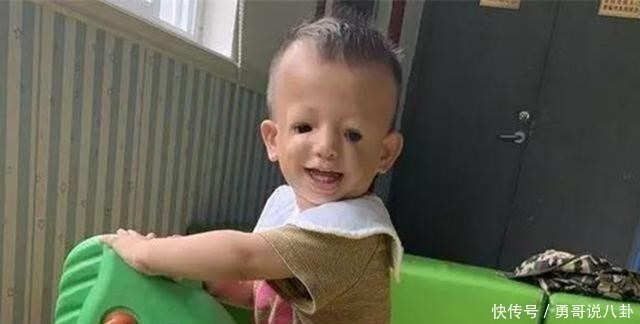 怀孕|“鸟脸”妈妈不顾劝阻生二胎,二宝没躲过遗传,是任性还是母爱