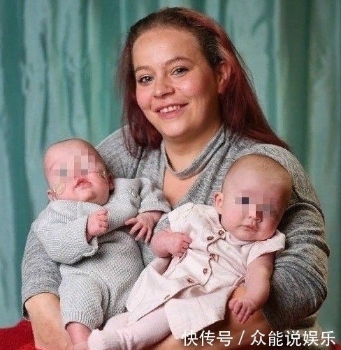 泰勒|奇闻:女子孕检是双胞胎,10个月后生下一个双色婴儿,嵌合体?