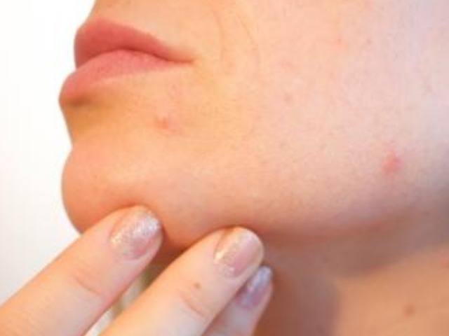 脸蛋|脸蛋出现3个预兆,可能就是得了妇科炎症,若没有说明身体健康