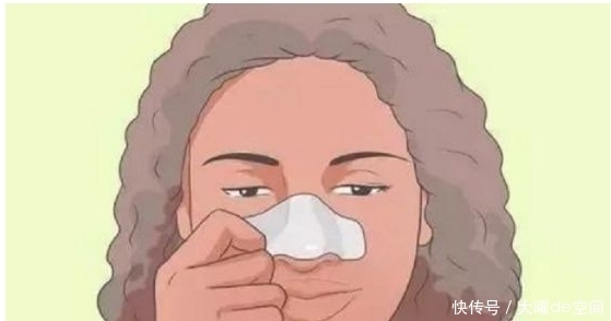 鼻子不干净都是黑头，医生，不是黑头是脂质微丝