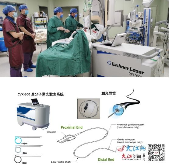 手术治疗|南昌大学二附院运用省首台新型激光治疗仪成功治疗高危复杂冠心病