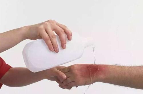 宝妈|一岁孩子被沸水烫伤,看到宝妈的处理方式,医生竖起大拇指