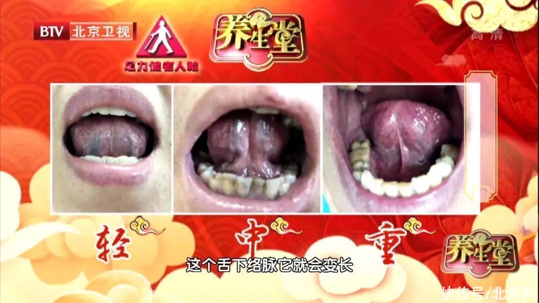 红曲|护血管只知道吃三七？天然“血管清道夫”，中医常用它泡水喝