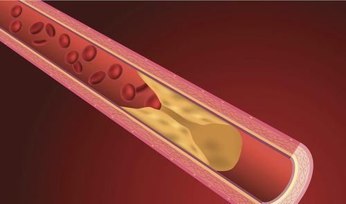 手上青筋很多很明显,究竟是不是血栓的征兆,危害大吗