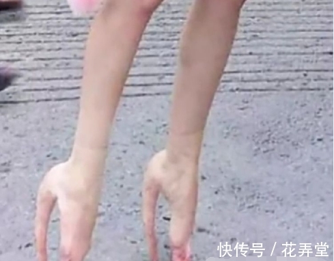 美女|美女街头露出“畸形”脚，上前询问后，顿时无法淡定