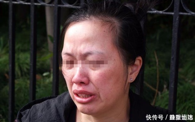 眼睛|8岁男孩20分钟眼睛被“熔化”,这种东西你家也有,父母要小心