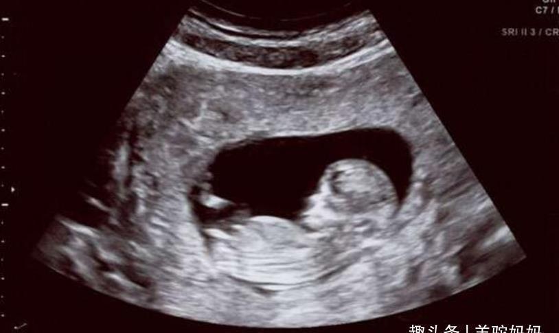 宝宝|在孕期若宝妈身上有这些现象,是宝宝在“报平安”,父母提前了解