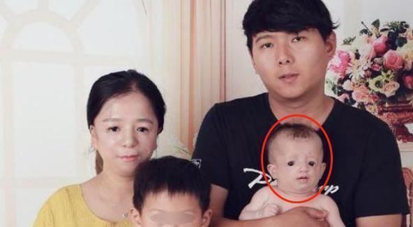 孩子|“鸟脸”妈妈不顾劝阻坚持生二胎,二宝顺利出生后,全家人都嫌弃
