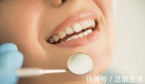 牙科医生|15岁男孩长出“尖牙”,妈妈亲手摸过后吐槽:养了个“吸血鬼”