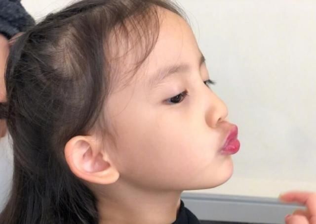 维生素d|宝宝出生后容易缺维生素D家长不要盲目喂鱼肝油,这些事要懂