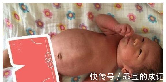 宝宝|宝宝肚子鼓得像气球?多半是胀气,教你几招帮宝宝把“屁”请出来