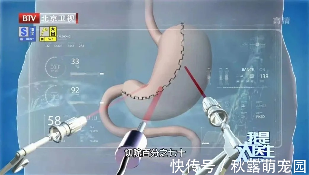 热量|2个鸡爪,热量堪比2.5碗米饭!减肥期间,这些食物可能会越减越肥