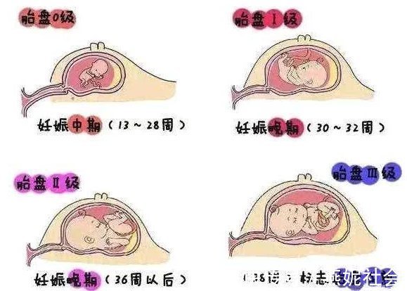 医生|孕晚期最后一个月，做产检时，要记得问医生4个问题！