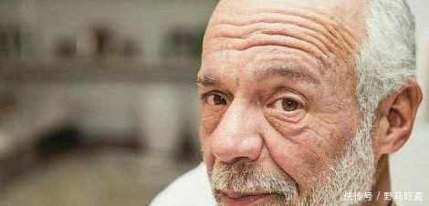 衰老|鼻毛为何会变白？八成与此3个原因有关，大多数人还不清楚