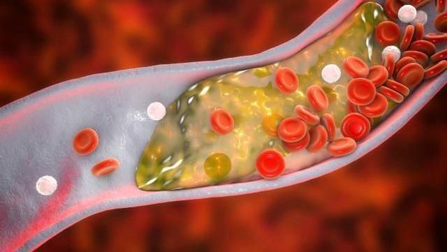 肥胖|血糖超标的人，身体可能出现3个异常，若没中，血糖还算平稳