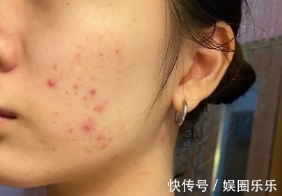 氨基酸 谁说国货护肤品不如日韩这些“宝藏”级护肤品,我只想无限回购!