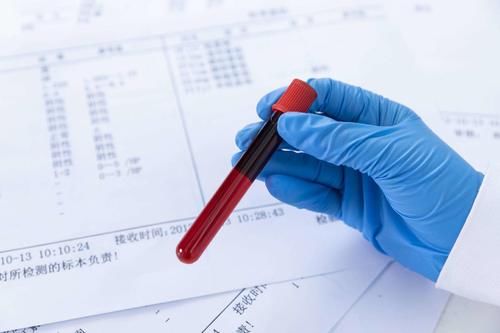 维生素C、铬能降血糖？过多维生素C恐影响血糖仪数值，医生告诉您