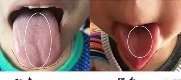 过冬|冬至后,阳虚的同志们该如何过冬?
