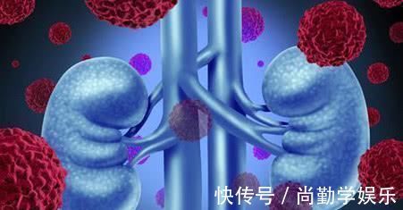 透析|患上尿毒症，还能活多久？医生坦言：三种情况，不容乐观!