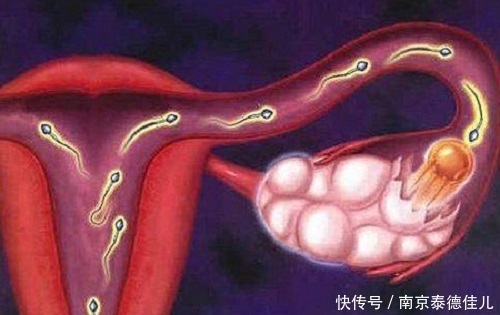 试管|多囊试管不易,准爸可以为准妈做些什么?