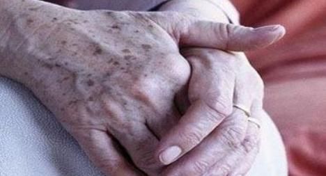 专家|为什么年纪大了容易有“老年斑”?专家说:常吃2物,可及时避免