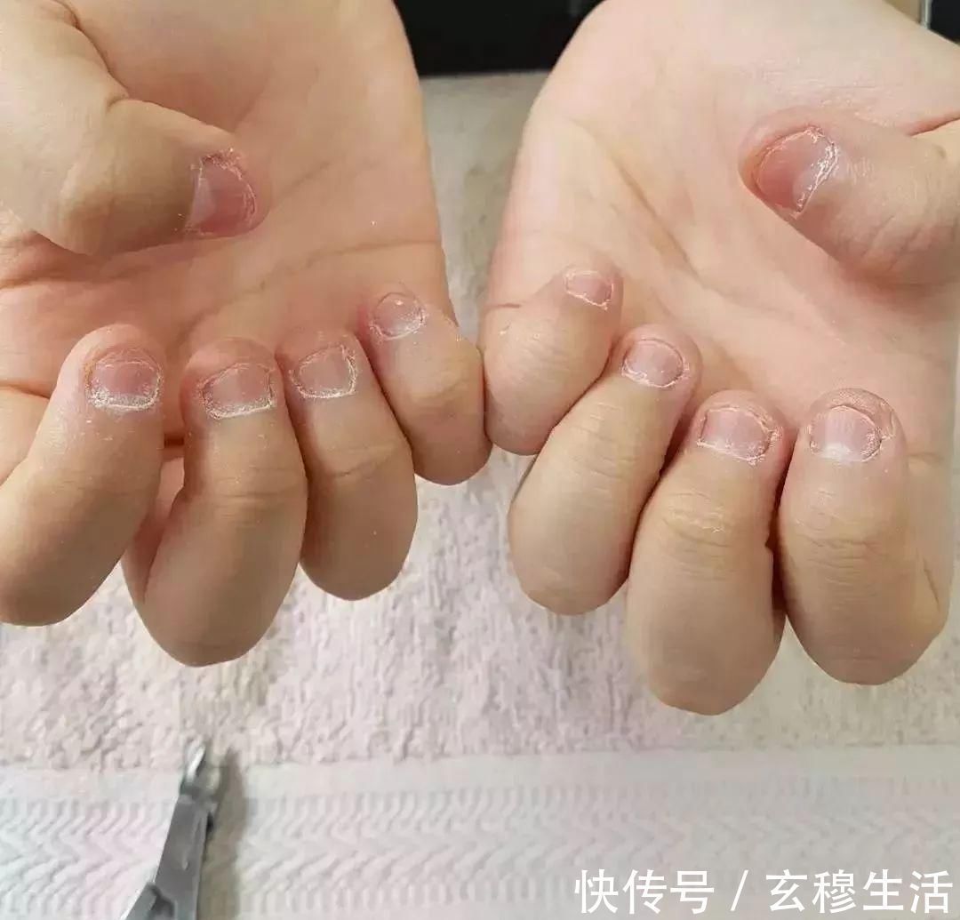 性格|一咬指甲就咬到“秃”的孩子,长大不仅影响性格,还影响身体健康
