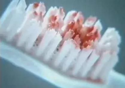 肝脏|为何肝癌发现就是晚期?很有可能是你忽视了肝脏向你发出的警告