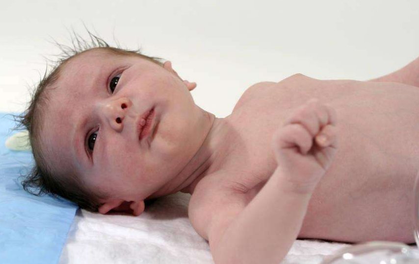 孩子|如何有效纠正新生儿斜颈很多父母都不知道
