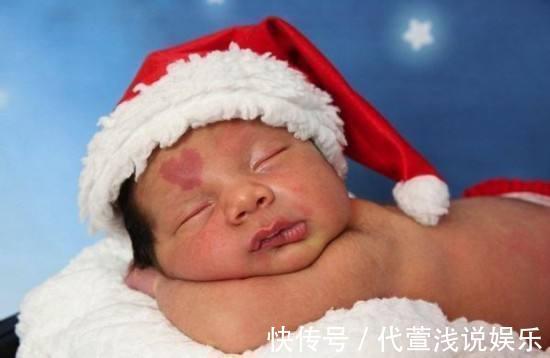 胎记|要想宝宝出生后不长胎记,孕期避免这几件事就OK,你做到了几条