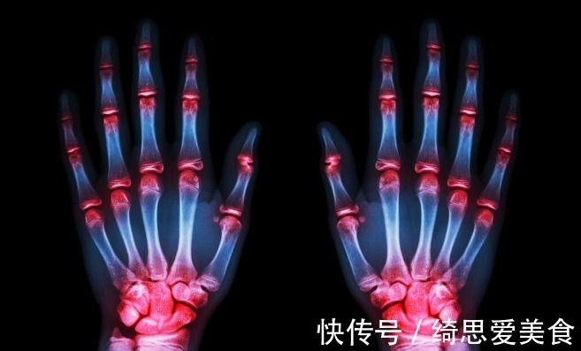 疼痛|为什么更年期的女性出现各种疼痛?该咋办?请看此文,医生告诉您