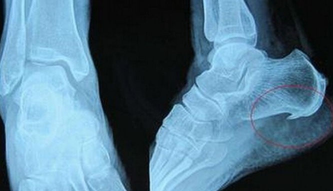 忽悠|5种病无法根治!忽悠能根治是骗你,莫轻信谣言,搞得人财两空!